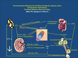 Chronic Kidney Disease And The Skeleton Bone Research
