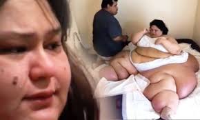 Une égyptienne, qui serait la plus grosse femme du monde, sera opérée en inde pour une chirurgie de réduction de poids, a indiqué le praticien qui effectuera l'opération. Cette Femme De 450 Kg Perd 360 Kg Apres Avoir Faussement Avoue Avoir Tue Son Neveu De 2 Ans En Roulant Sur Lui Epoch Times