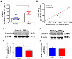 Epec provides complete iot & connectivity solutions for remote maintenance, diagnostics, fleet more than just hw, epec offers: Enteropathogenic Escherichia Coli Epec Infection Induces Diarrhea Intestinal Damage Metabolic Alterations And Increased Intestinal Permeability In A Murine Model Biorxiv