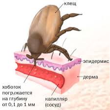 Pervaya Pomosh Pri Ukuse Klesha