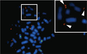 But the list doesn't end there, and some cancers even share a cancer color. Non Coding Dna Located Outside Chromosomes May Help Drive Glioblastoma