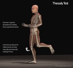 Image result for Thessaly Test