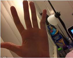 Usually only found on the index or little finger. Think You Have Smartphone Pinky It S Probably All In Your Head Photos Oregonlive Com