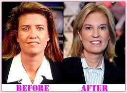 Jun 29, 2017 · john coale john coale is the former tort lawyer husband of journalist and tv anchor, greta van susteren. Greta Van Susteren Quotes Quotesgram