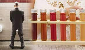 The american bladder cancer society state that bladder cancer accounts. Bladder Cancer Symptoms And Signs Check For This Colour Urine When You Go To The Toilet Express Co Uk