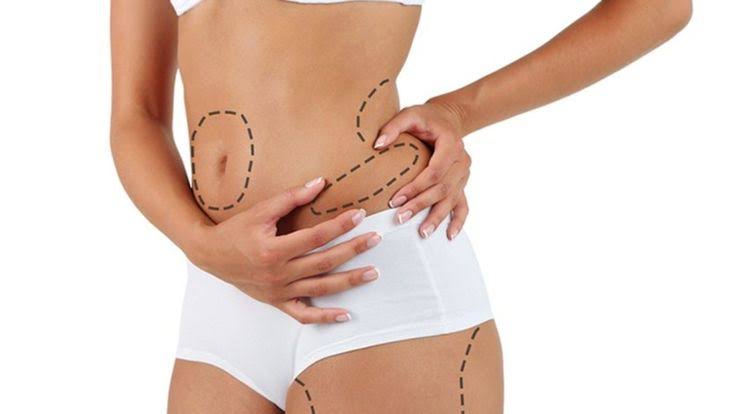 Cost Of Liposuction In UAE 2026