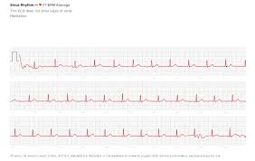Ecg Is Now Available On The Apple Watch In Sg And Here S What You Need To Know Hardwarezone Com Sg