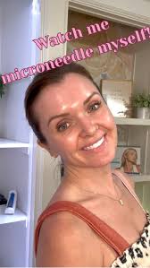 My clients like to ask how I do my own treatments, so here is a glimpse  into how I do my own microneedling treatment! , Microneedling is great for  anytime of year and