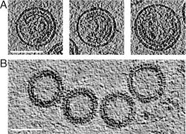 Check spelling or type a new query. Structure And Assembly Of Immature Hiv Pnas