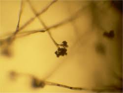 Image result for Botrytis cinerea