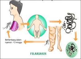 Check spelling or type a new query. Grobogan Endemis Kaki Gajah Grobogan Top News
