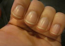 Tiny black lines or dots under nail can simply be as a result of an injury, a nail infection or different underlying medical condition. Tutorials Peg Legs Polish