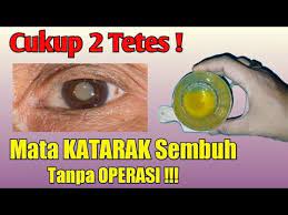 Cukup 2 Tetes Mata Katarak Sembuh Tanpa Operasi Bagus Herbal Youtube Operasi
