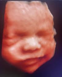 Sneak Peek 4D Ultrasounds