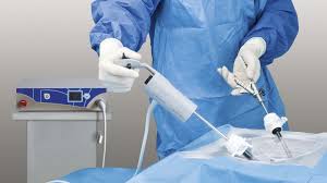 Laparoscopic Surgery Pelvic Region Laparoscopic Surgery Surgery