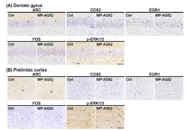 How big are enloy stainless steel kitchen canisters? Continuous Exposure To A Glycosyl Isoquercitrin From Developmental Stages To Adulthood Is Necessary For Facilitating Fear Extinction Learning In Rats Toxicologic Pathology