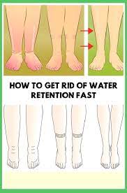 Otherwise, there are many small changes, particularly when it comes to diet. 12 Simple Remedies To Avoid Water Retention In Your Body Shape Your Body Water Retention Remedies Foot Remedies Swollen Feet Remedy