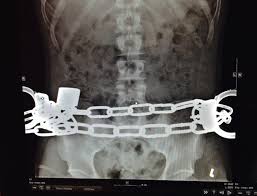 Image result for Body Stuffer