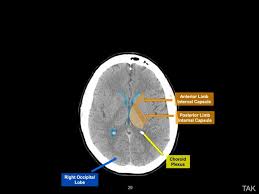 Image result for CT Head