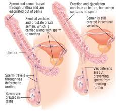 It's usually carried out under local anaesthetic, where you're awake but don't feel any pain, and takes about 15 minutes. Vasectomy Cairns Important Information For Patients