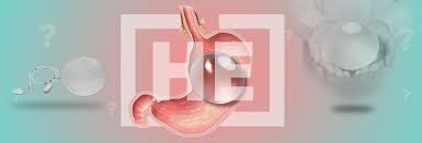 Maybe you would like to learn more about one of these? Que Es El Balon Gastrico Y Cuanto Cuesta Dr He Obesity Clinic