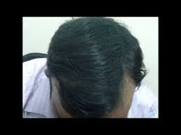This creamy hair color brings you the ease of colouring your hair from the comfort of your home. Do You Want Fuller Looking Hair In Just 30 Seconds Watch This Youtube