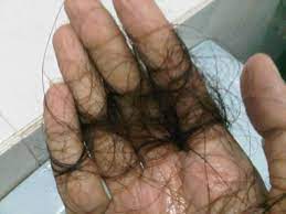 Masalah kelumumur dan rambut gugur amat tidak menyenangkan. Main Bedal Jer Mana Lah Tak Gugur Ini Cara Syampu Rambut Yang Betul Untuk Lelaki Dan Wanita