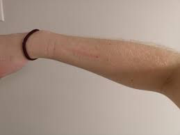 This dermatologist tested formula is gentle on skin and effective on hair. Despite My Arm Hair I Am Not A French Man But This Is My Reality Coming Out Of The Shower And I Don T Care Anymore Enjoy Your Arm Hair Make Teepees