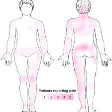 The area in question is south of the zambezi basin, in northern botswana. Body Map Over Pain Location In Cp Group Notes Colored Areas Download Scientific Diagram