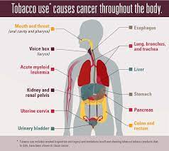 The screening needs to change its. Tobacco And Cancer Cdc