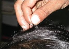 Image result for Hair Pull Test