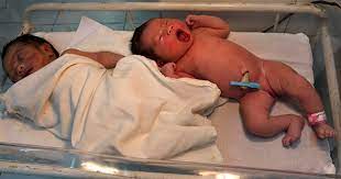 Not Cutting Umbilical Cord Immediately May Boost Baby S Health Cbs News