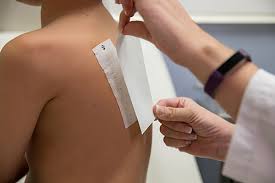 Image result for Patch Testing