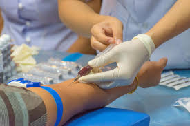 Ana Blood Test Purpose What To Expect Results Explained And More