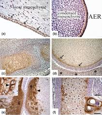 Picture of the bone, the matrix, and and osteocyte for students to color to help them study. Cartilage Oligomeric Matrix Protein Is Involved In Human Limb Development And In The Pathogenesis Of Osteoarthritis Arthritis Research Therapy Full Text