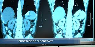 Image result for CT Intravenous Contrast