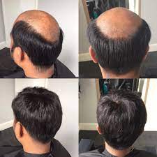Our stylists specialize in haircuts and color. Men S Hair Replacement Available At Gg S Plymouth Hair And Beauty Salon Hair Replacement Hair Loss Men