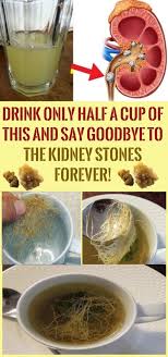 Kidney Stones Health Remedies Kidney Detox Cleanse Kidney Stones