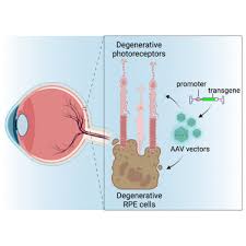 Image result for Blue 1998 AAV