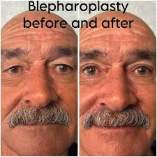 Great first couple of days at the Plastic Surgery Congress in Sydney  including a fantastic talk