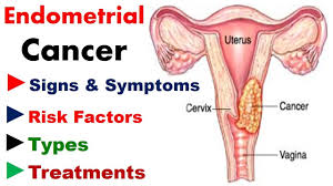 The most likely symptoms are: Endometrial Cancer Signs Symptoms Risk Factors Types Treatments Cancer Knowledge Youtube