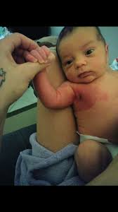 Hi!! Happy to find this group! Our 4 yr old has extensive venous vascular  malformations in several locations inside and outside his body, incl in  joints and muscles. We just attended a