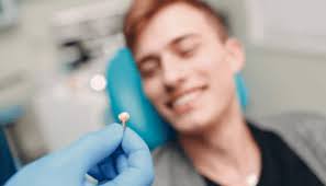 Implantes dentales en Cajamarca