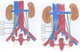 Ovarian Vein Syndrome A Review Sciencedirect