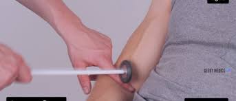 Image result for Supinator Reflex