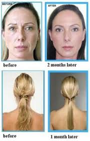 Genesis Pure Corp. Puerto Rico