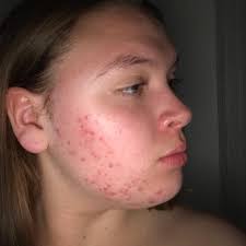 Mariah Day-Tims (@bluesquareskincare) • Instagram photos and videos