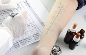 Histaminallergie Ursachen Symptome Und Therapie Heilpraxis