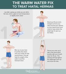 Hiatal Hernia Symptoms Causes And Natural Support Strategies Hernia Exercises Hiatal Hernia Diet Hiatus Hernia
