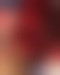 閲覧注意】女「朝起きたら犬が私の体をほとんど食べていた…」とかいう恐怖画像 - ポッカキット